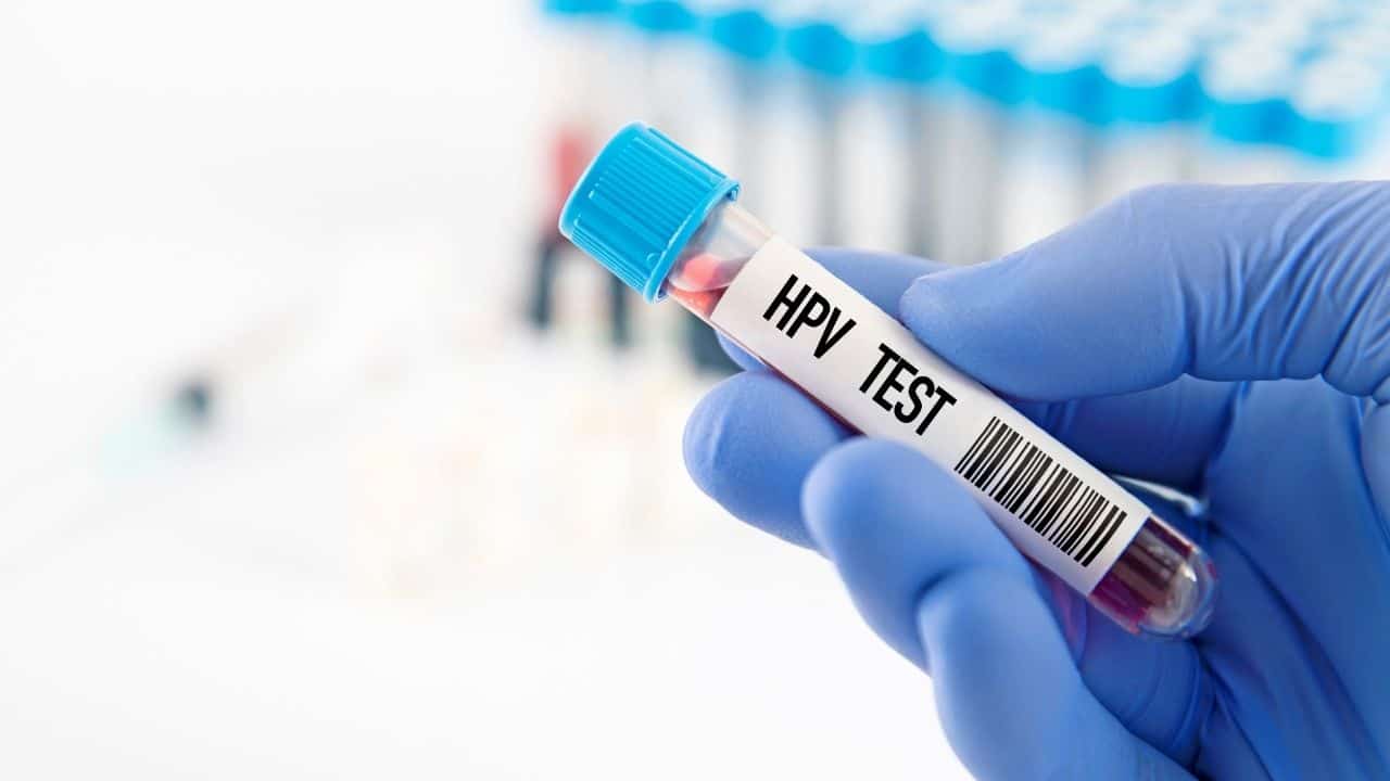 HPV Enfeksiyonu Hakkında En Çok Sorulan Sorular!
