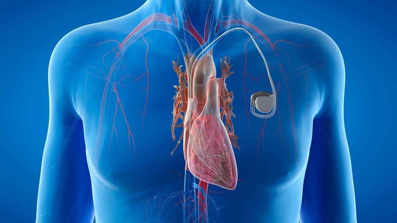Ritim Bozukluğu Nedir? Çarpıntı ile Olan İlişkisi Nasıldır?