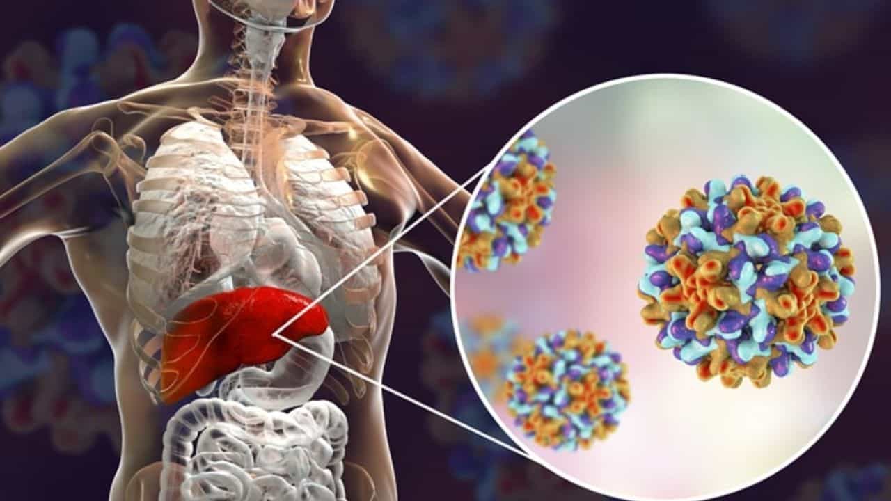 Enfeksiyon ve Hepatit