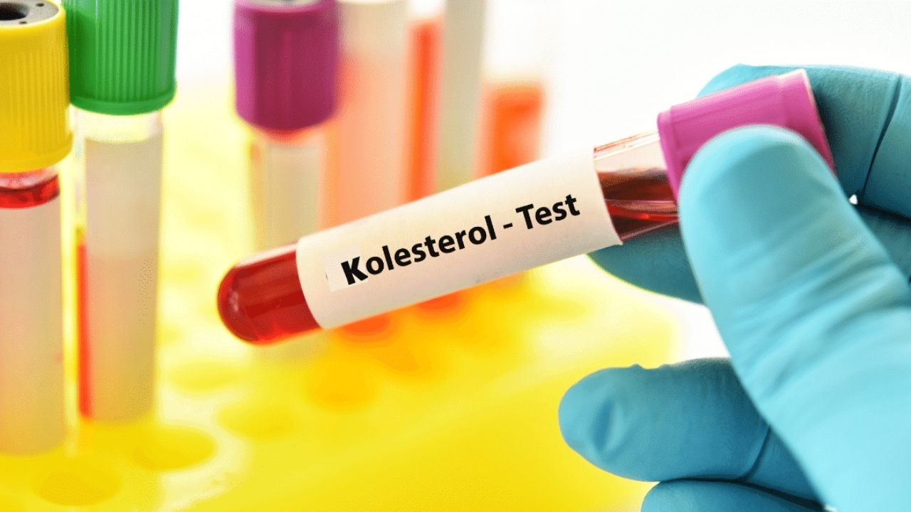 Kolestrol Testi Nasıl Yapılır?