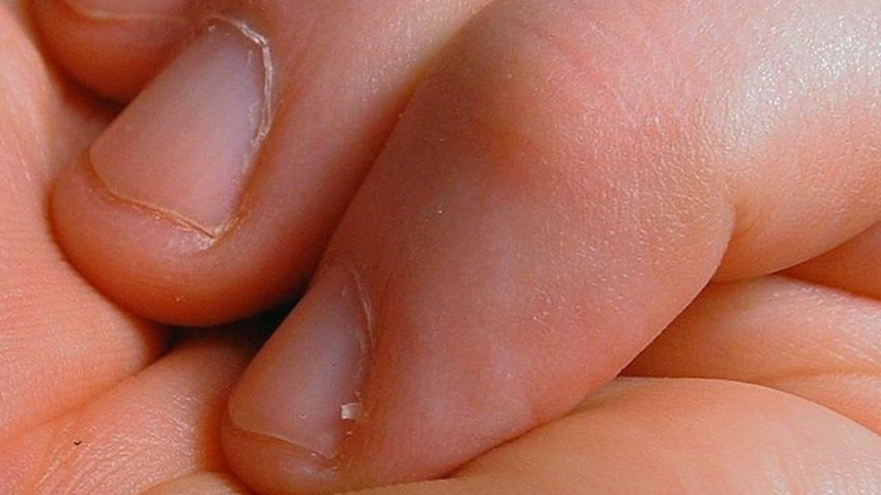 Şeytan Tırnağı Nedir? Eklem ve Sırt Ağrılarına Çözüm Olabilir mi?
