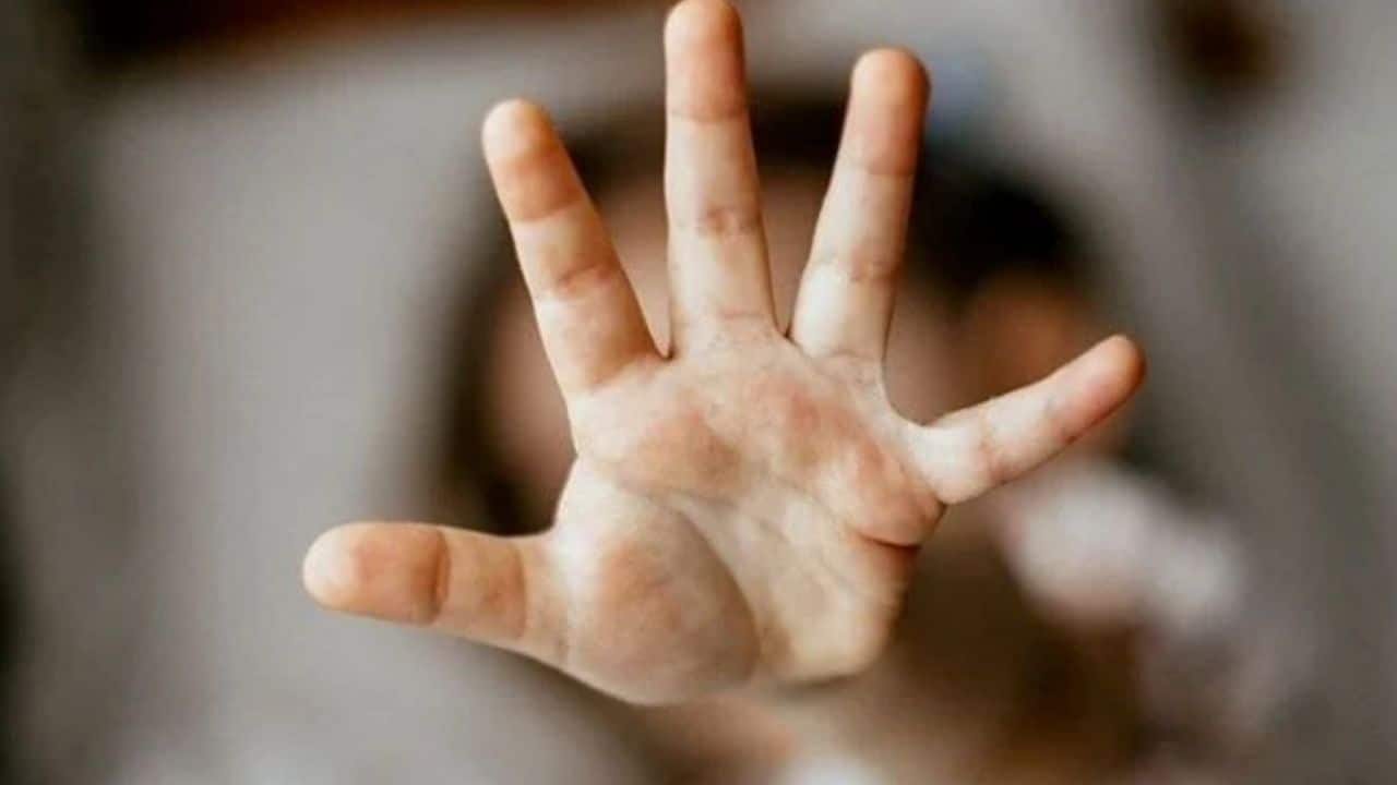 Şanlıurfa’da 5 Yaşındaki Çocuk Cinsel İstismara Maruz Kaldı mı? İddialar ve Soruşturma Devam