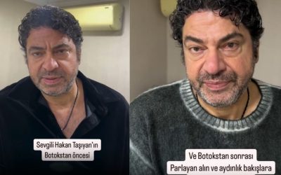 Hakan Taşıyan: Estetikli Erkek Ünlüler Arasında Yerini Aldı