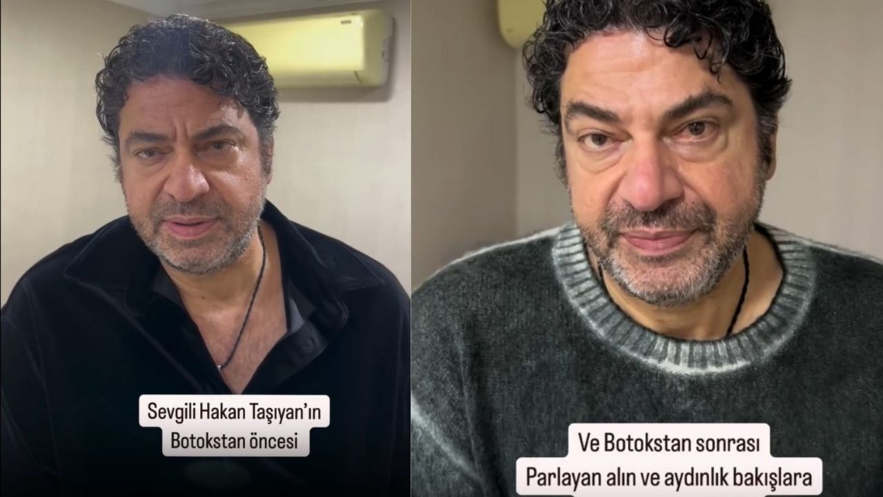 Hakan Taşıyan Estetikli Erkek Ünlüler Arasında Yerini Aldı (1)