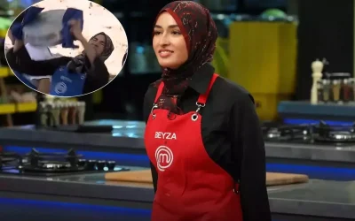 MasterChef Beyza, Yanık Yüz Fotoğrafını Paylaştı