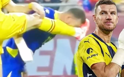 Edin Dzeko’nun korkunç yüzü! Burnu kırıldı, bakan bir daha bakamıyor
