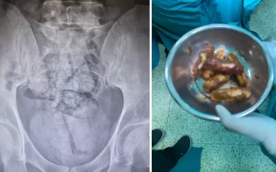 İranlı Şüpheliden 350 Gram Uyuşturucu Çıktı