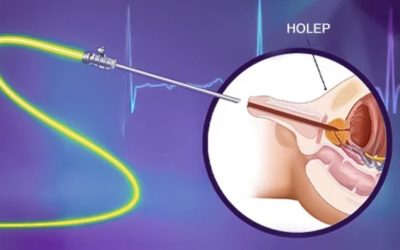 Prostat Ameliyatı: İyileşme Süreci ve Sonuçlar
