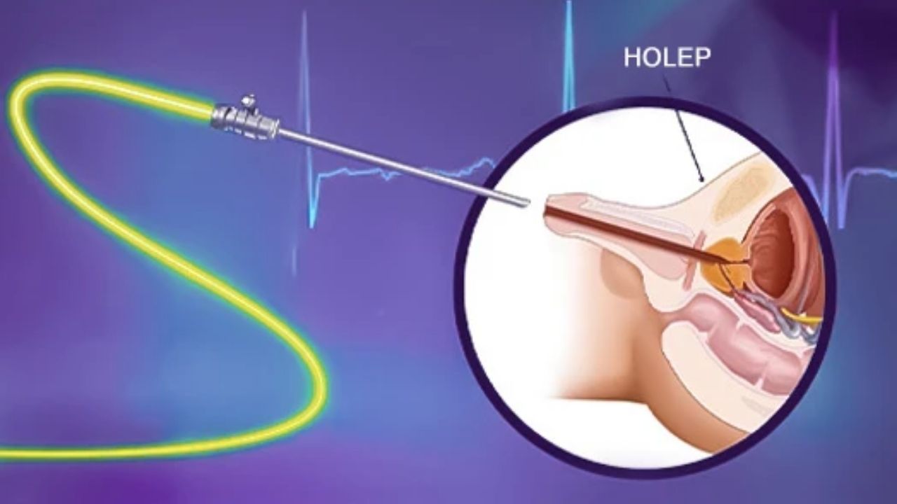 Prostat Ameliyatı İyileşme Süreci ve Sonuçlar