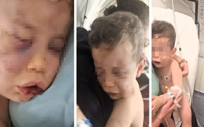 2 yaşındaki bebek, annesinin sevgilisi tarafından öldüresiye dövüldü