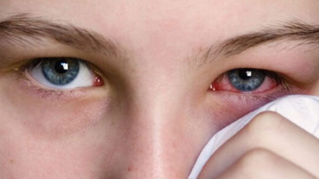 Gözde Kaşıntı Uzun Sürerse Hangi Doktora Gidilmeli