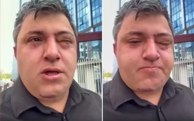 Altındağ Belediye Başkanı Tiryaki’nin Belediye İşçisine Saldırısı