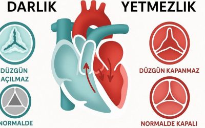 Aort Kapak Yetmezliği’ndeki En Sık Görülen Semptomlar