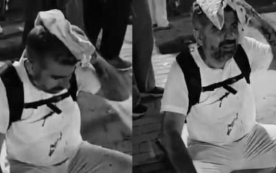 Mısır’da saldırıya uğrayan HÜDA PAR’lı Dinç, konuştu