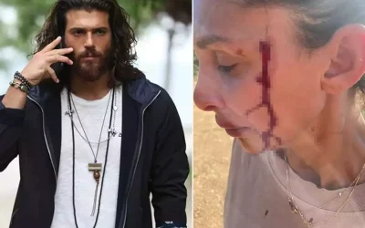 Can Yaman’ın sevgilisi Sara Bluma şiddet mağduru olduğunu belirtti