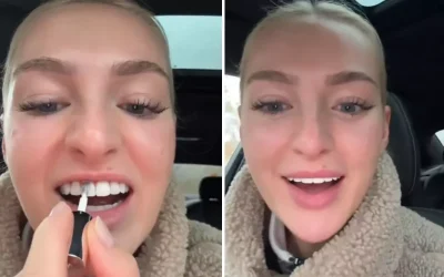 Dişlerini beyazlatmak için attığı inanılmaz adım!