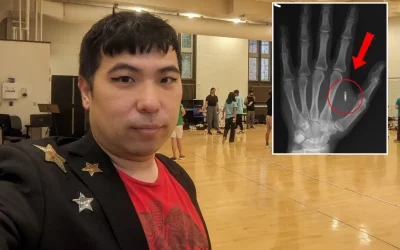 Mikroçipin şifresini unutan adamın akılalmaz hatası